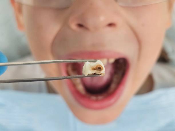 Best Emergency Dentist for Special Needs Patients in Chapman, KS